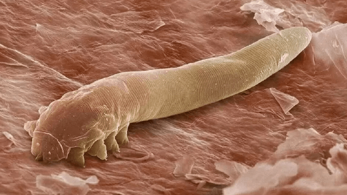 Parasiten am mënschleche Kierper