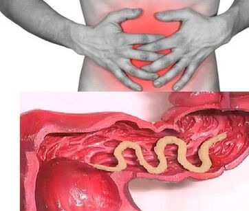 Mënschen Parasiten