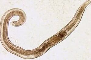 Parasiten vun engem Mann vu Schnëtt