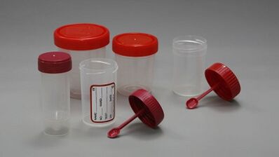 Wéi preparéiert Iech op den Test vu Parasiten