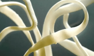 wéi d'Parasiten aus dem mënschleche Kierper ewechhuelen